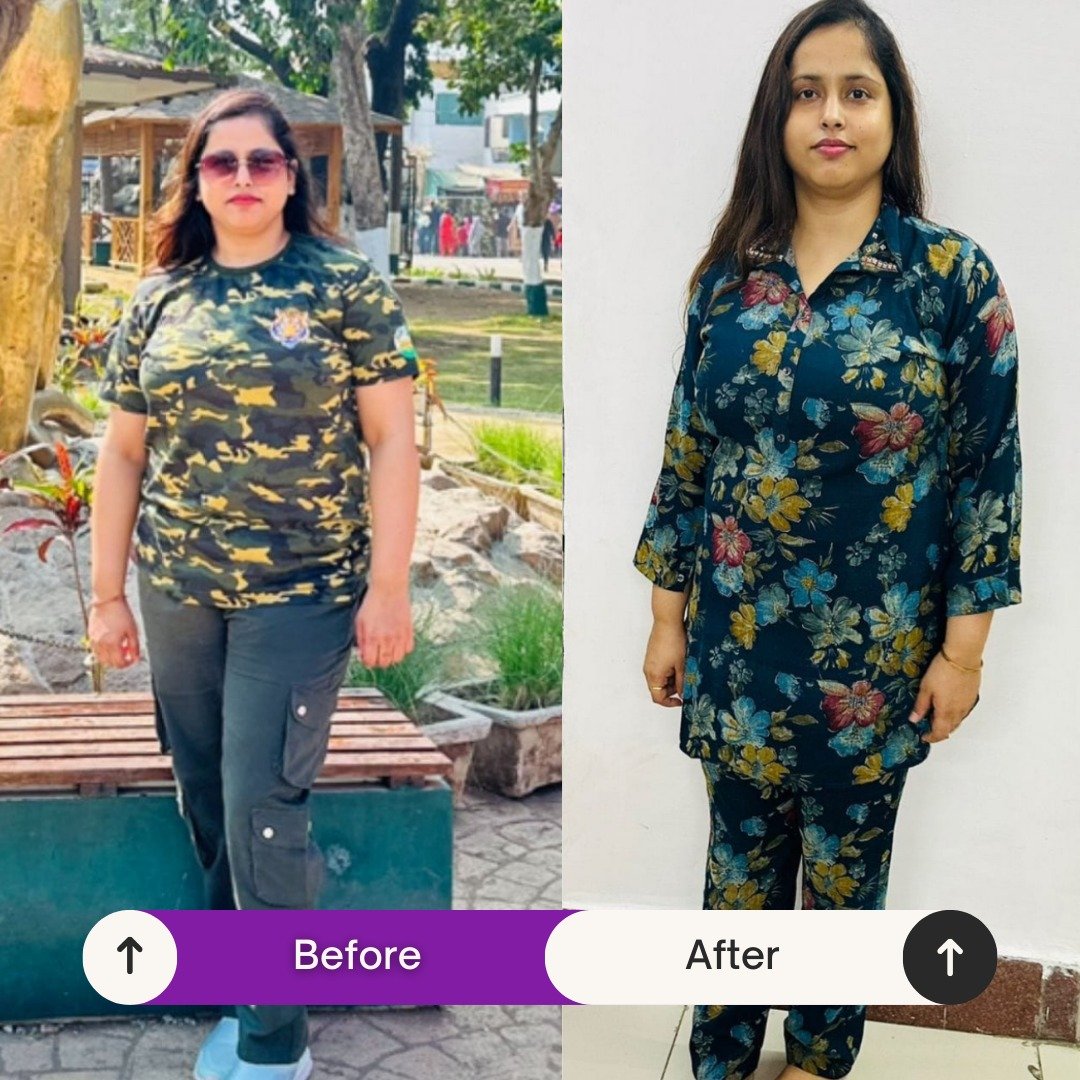 Transformation 10
