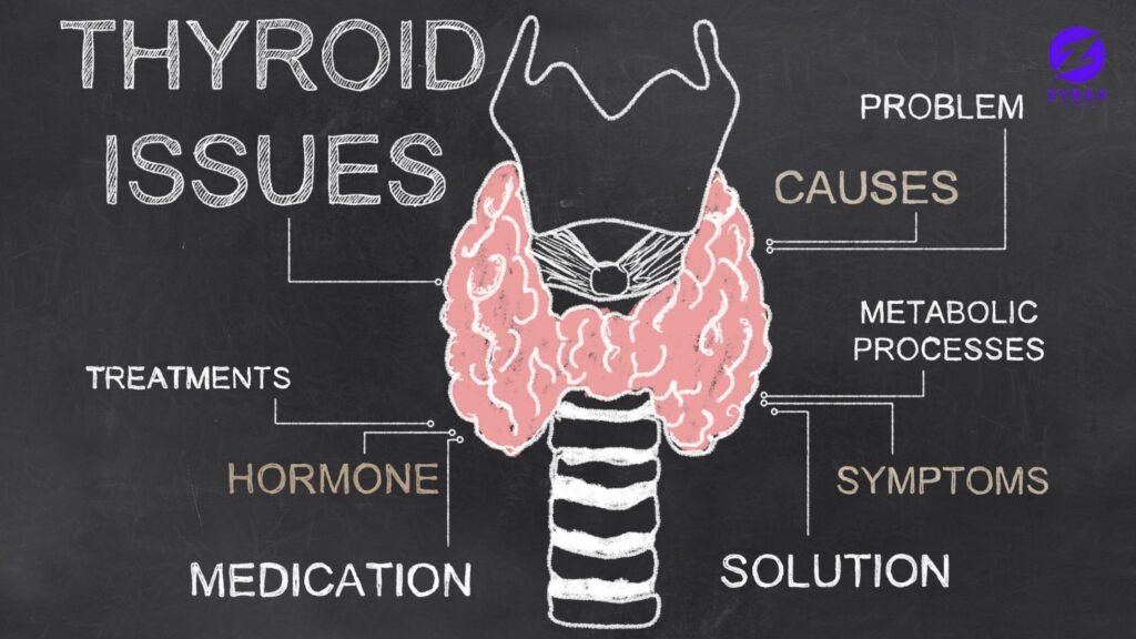 Thyroid